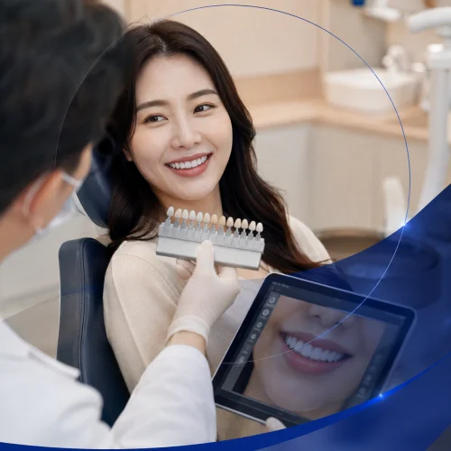 구리치과 라미네이트 대표 이미지